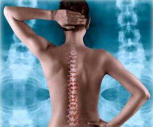 Απεικόνιση της οπίσθιας σπονδυλικής στήλης